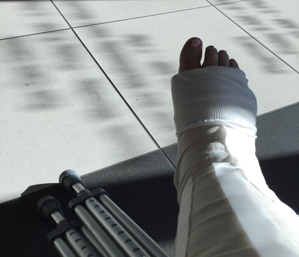 Ankle Cast &amp; Crutches